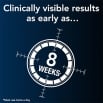 Regaine for Men Clinically visible results as early as 8 weeks