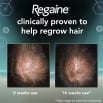 Regaine for Men Clinical trials before and after